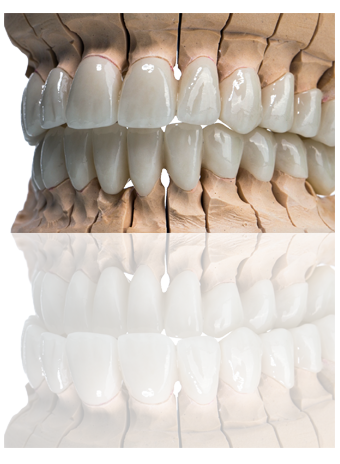 Dentarium Özel Şenol Gürbüz Diş Protez Laboratuvarı