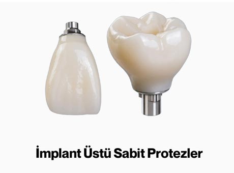 Dentarium Özel Şenol Gürbüz Diş Protez Laboratuvarı
