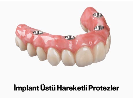 Dentarium Özel Şenol Gürbüz Diş Protez Laboratuvarı