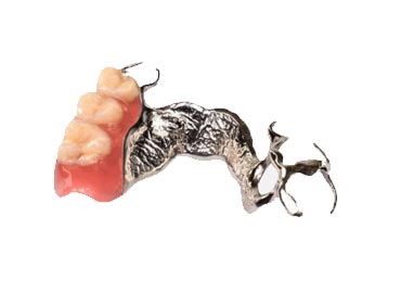   Metal İskelet