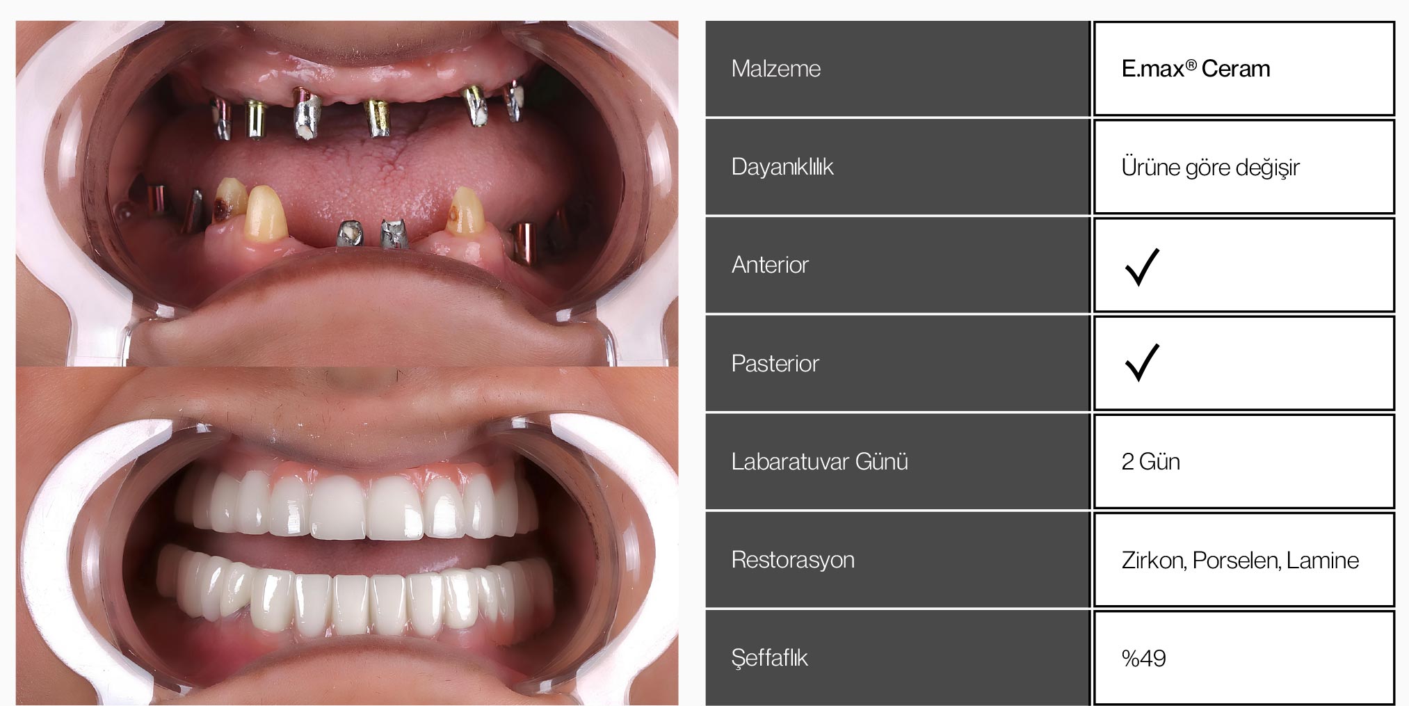 Dentarium Özel Şenol Gürbüz Diş Protez Laboratuvarı