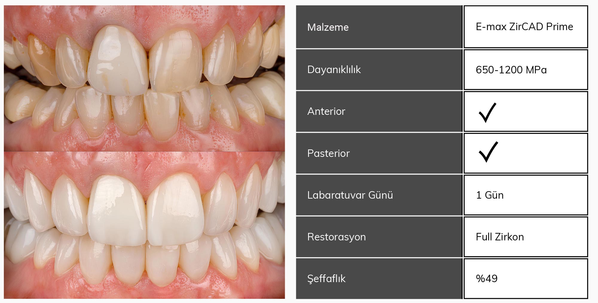 Dentarium Özel Şenol Gürbüz Diş Protez Laboratuvarı